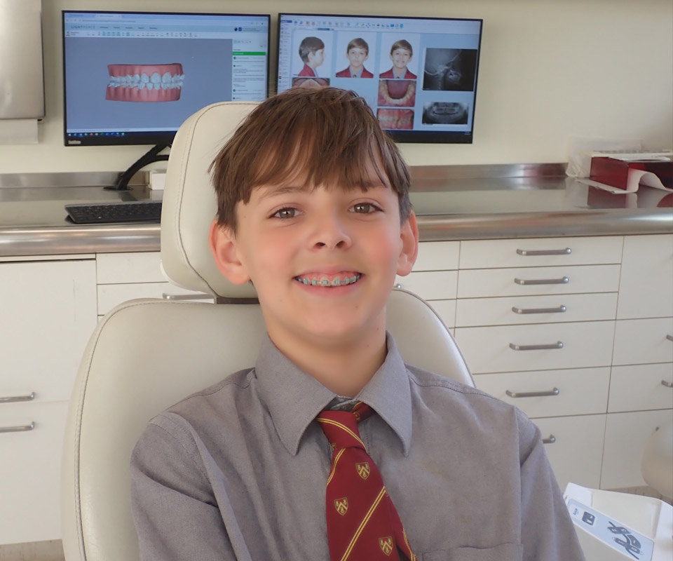 What are LightForce™ 3D braces?