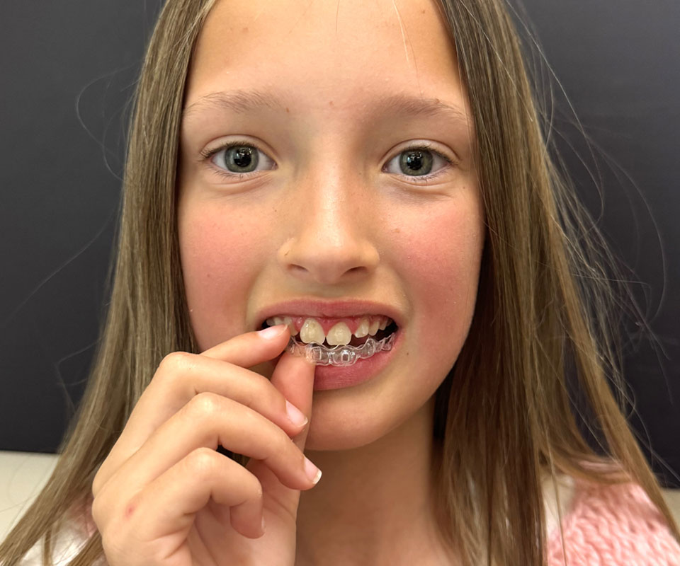 How do removable aligners help early treatment?